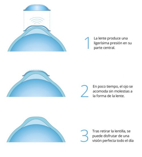 orto_3